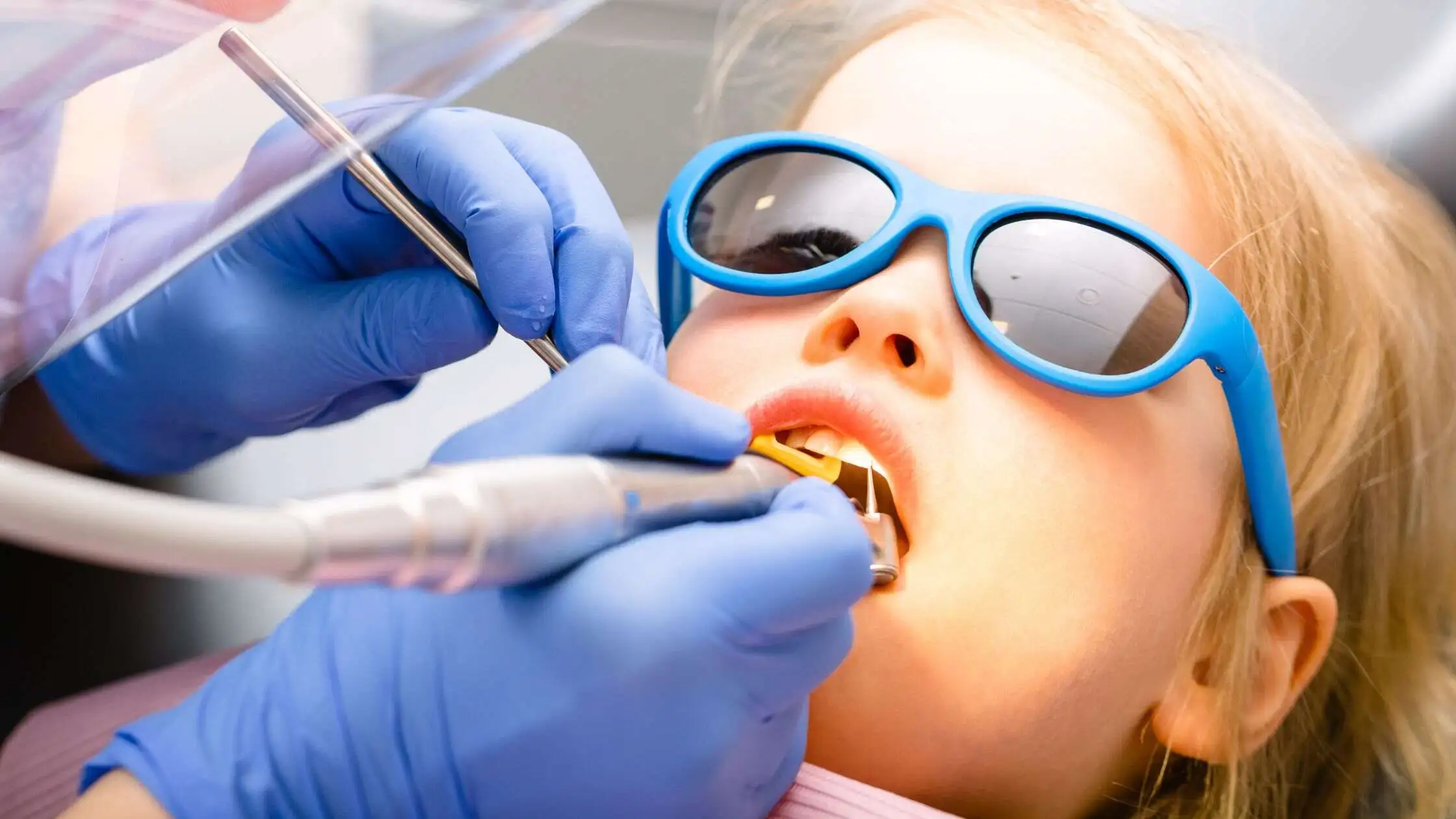 How Much Does it Cost to Fill a Cavity?