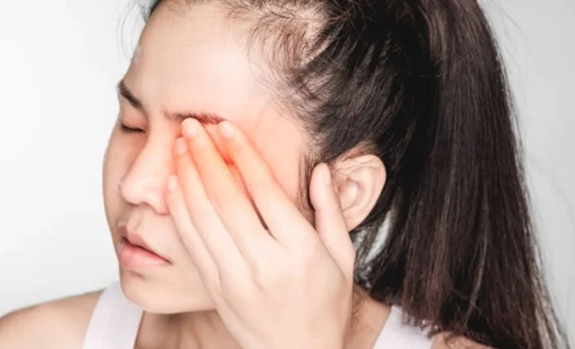 How to Get Rid of a Stye Overnight: Effective Home Remedies and Tips