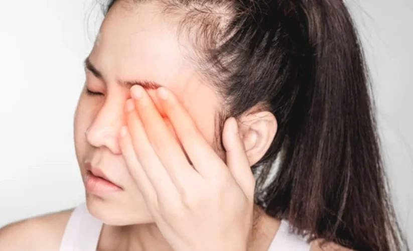 How to Get Rid of a Stye Overnight