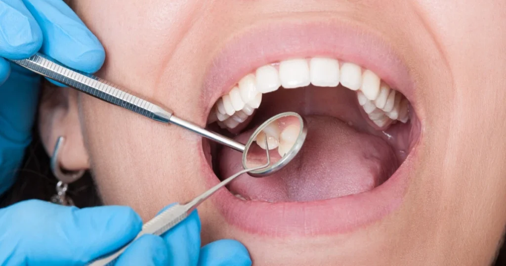 Recognizing the Symptoms of Tooth Septicity